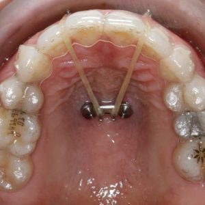 Journée d&rsquo;étude In Office – Sanary – TAD